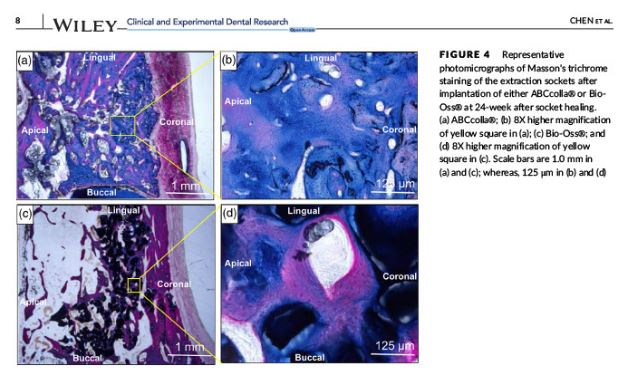 Evaluating the bone-regenerative role of the decellularized porcine bone xenograft in a canine extraction socket model