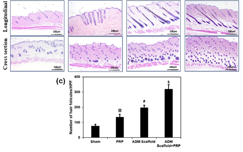 Porcine acellular dermal matrix facilitates hair follicle stem cells entering the hair cycle in C57/BL6 mice