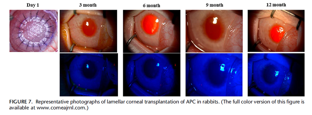 Acellular Porcine Cornea Produced by Supercritical Carbon Dioxide Extraction: A Potential Substitute for Human Corneal Regeneration