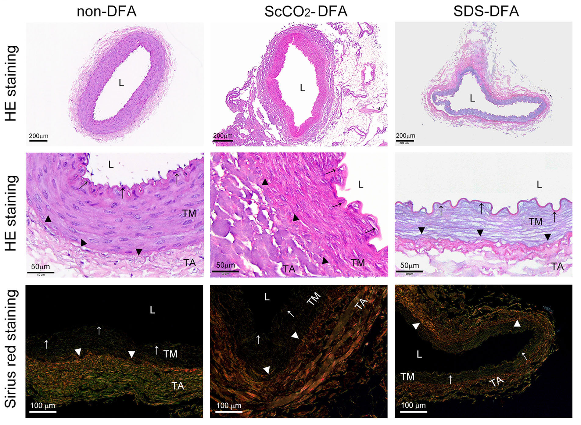 Supercritical carbon dioxide-decellularized arteries exhibit physiologic-like vessel regeneration following xenotransplantation in rats