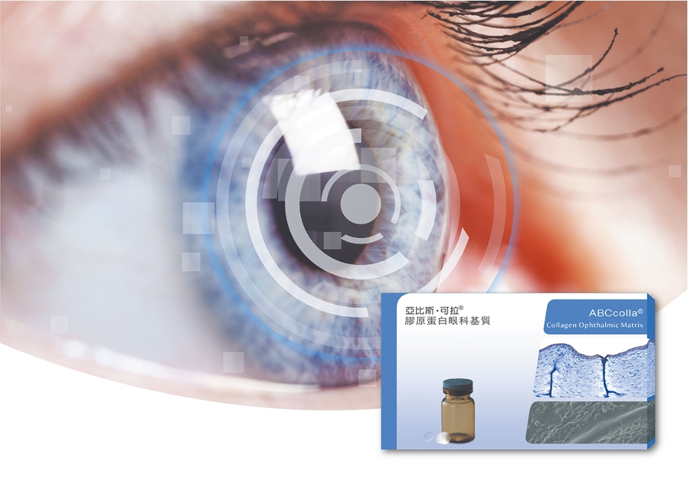 ACRO Biomedical Utilizes Innovative Collagen Ophthalmic Matrix to Save Patients from Waiting for Corneal Donation