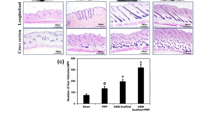 Porcine acellular dermal matrix facilitates hair follicle stem cells entering the hair cycle in C57/BL6 mice