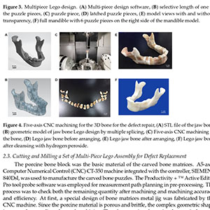Supercritical Carbon Dioxide Decellularized Xenograft-3D CAD/CAM Carved Bone Matrix Personalized for Human Bone Defect Repair